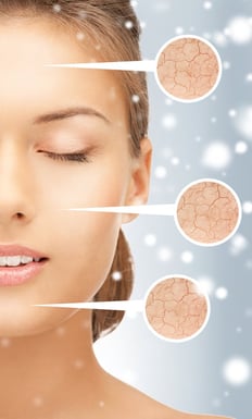 Winter-Proof Your Skin